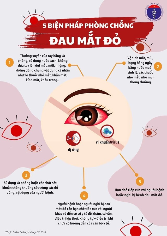 Bộ Y tế đề nghị các địa phương tăng cường phòng chống bệnh đau mắt đỏ -  Cổng thông tin điện tử tỉnh Kon Tum